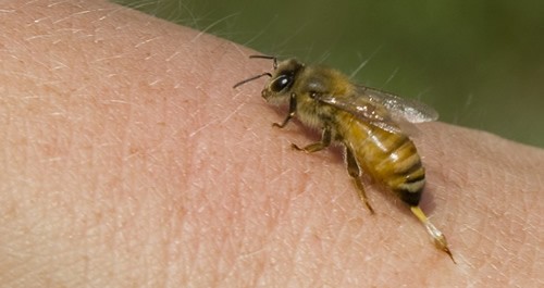 Home-Remedies-for-Bee-Sting