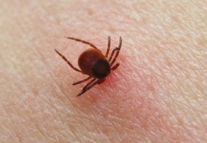 ticks-pediatric-expert-tips